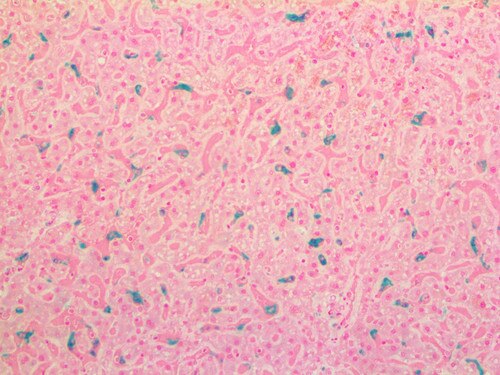 IHC of Macrophage on an FFPE Liver Tissue